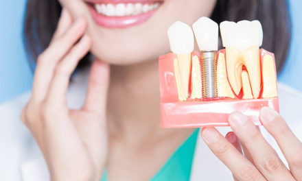 A Sneak Peek At The Future of Dental Implant Technology