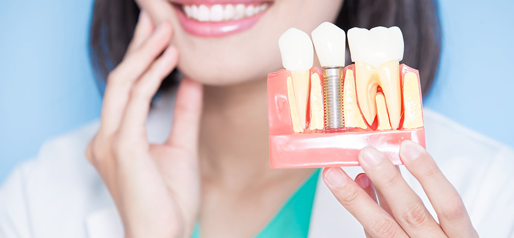 A Sneak Peek At The Future of Dental Implant Technology